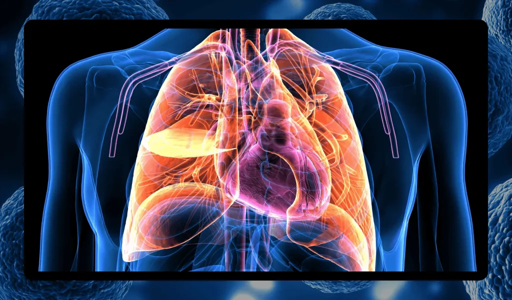 X-Ray image of the upper torso of a human also showing major organs